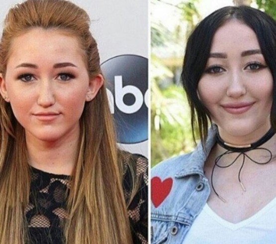 IMG 7646 Miley Cyrus' teenage sister gets plastic surgery and now she looks like Pocahuntas (photos)