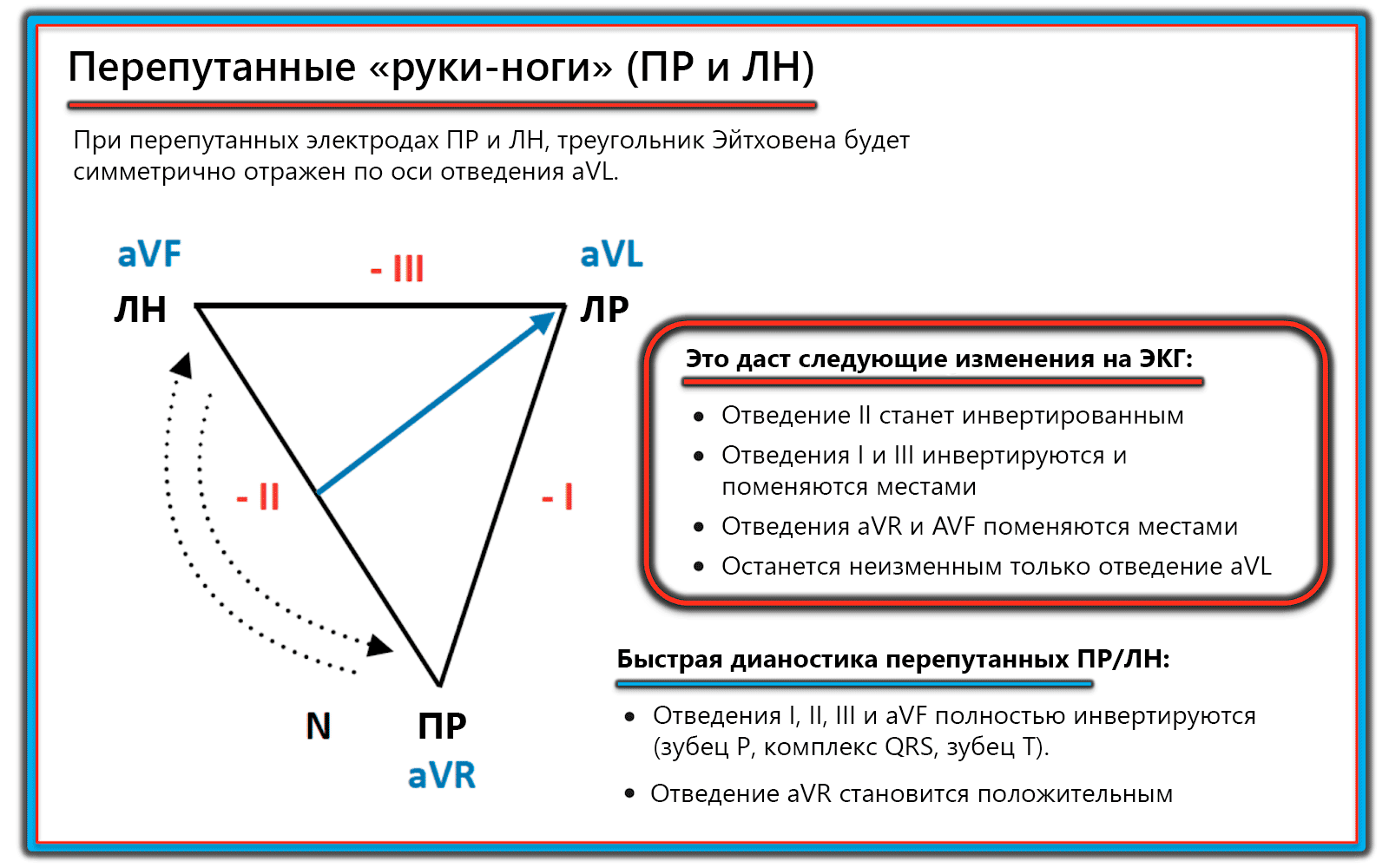 Схема положения. Критерии татарковского по зубцу т.