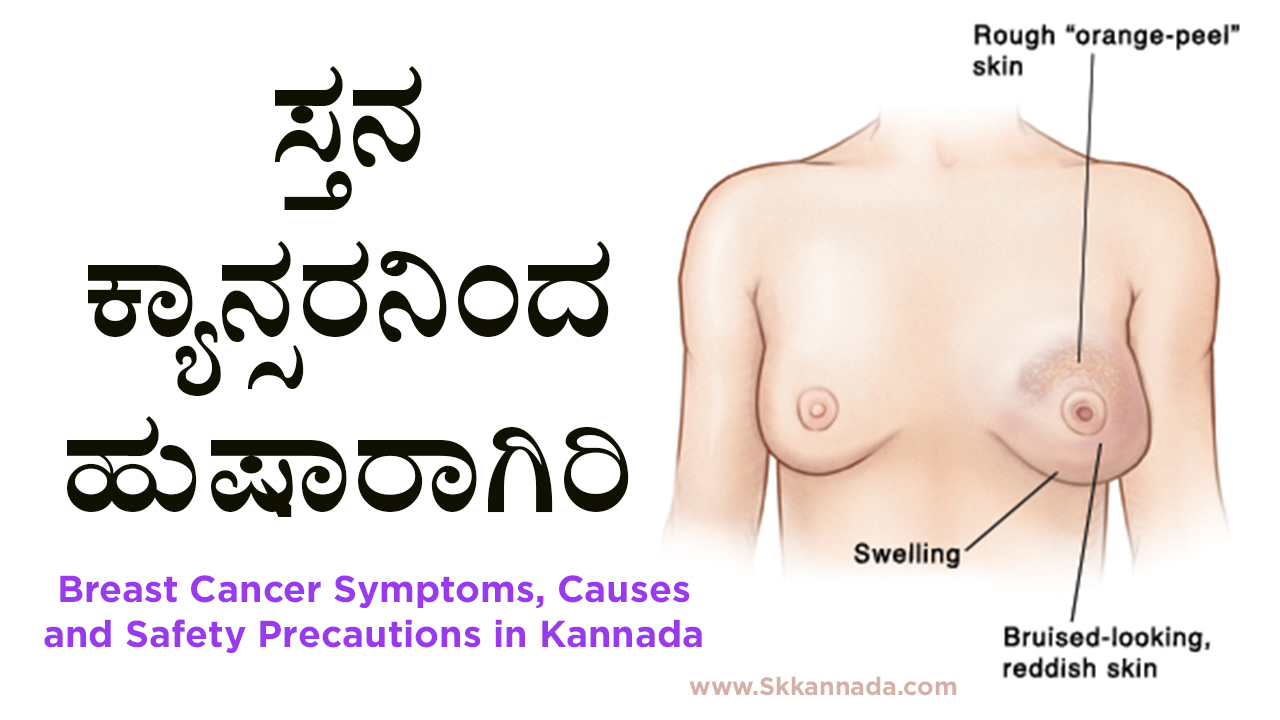 ಸ್ತನ ಕ್ಯಾನ್ಸರನಿಂದ ಹುಷಾರಾಗಿರಿ : Breast Cancer Symptoms, Causes and Safety Precautions in Kannada