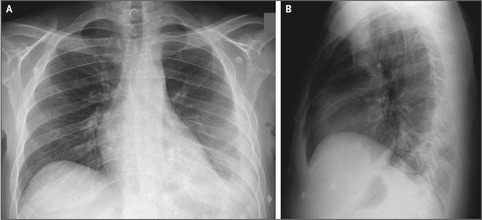 EL RINCÓN DE LA MEDICINA INTERNA. juanpedromacaluso@yahoo.com.ar: 19 ...