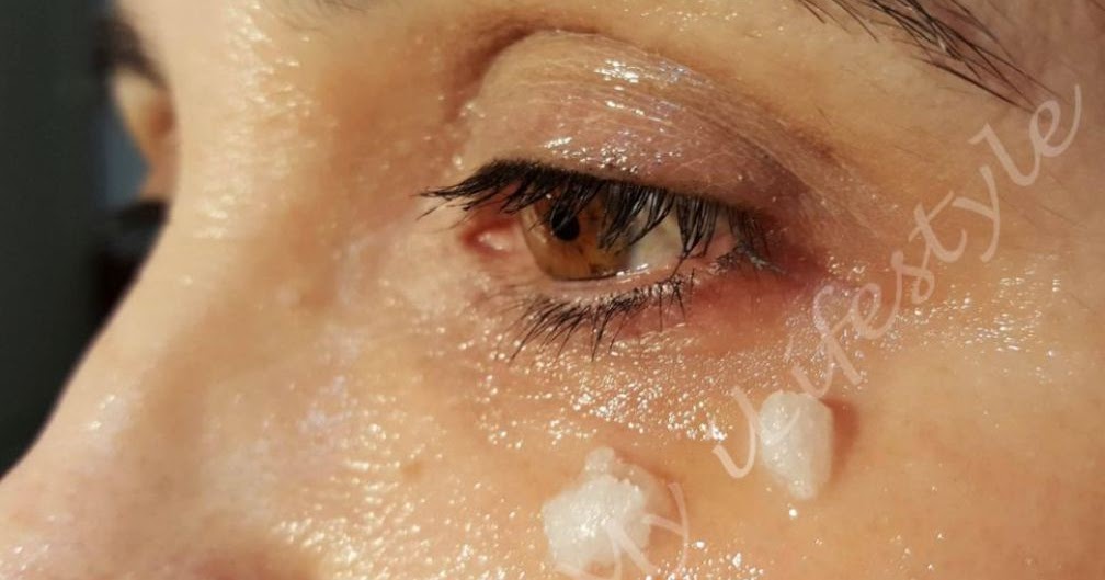 SHE STARTED APPLYING COCONUT OIL AROUND HER EYES. 5 MINUTES LATER