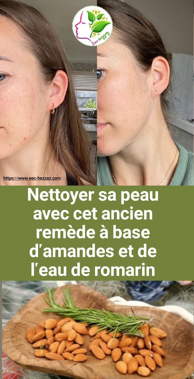 Nettoyer sa peau avec cet ancien remède à base d'amandes et de l'eau de romarin