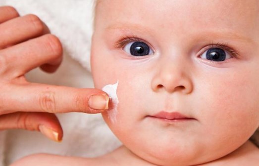 Kurap Pada Bayi Dan Cara Mengobatinya