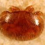 photo de varroa au microscope