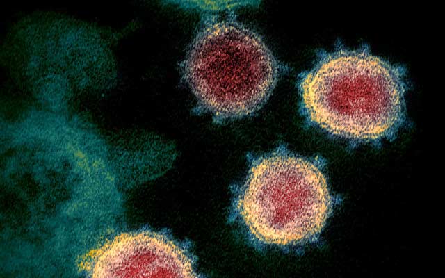 Bahia registra 20ª morte por Covid-19; paciente tinha 71 anos e era diabético