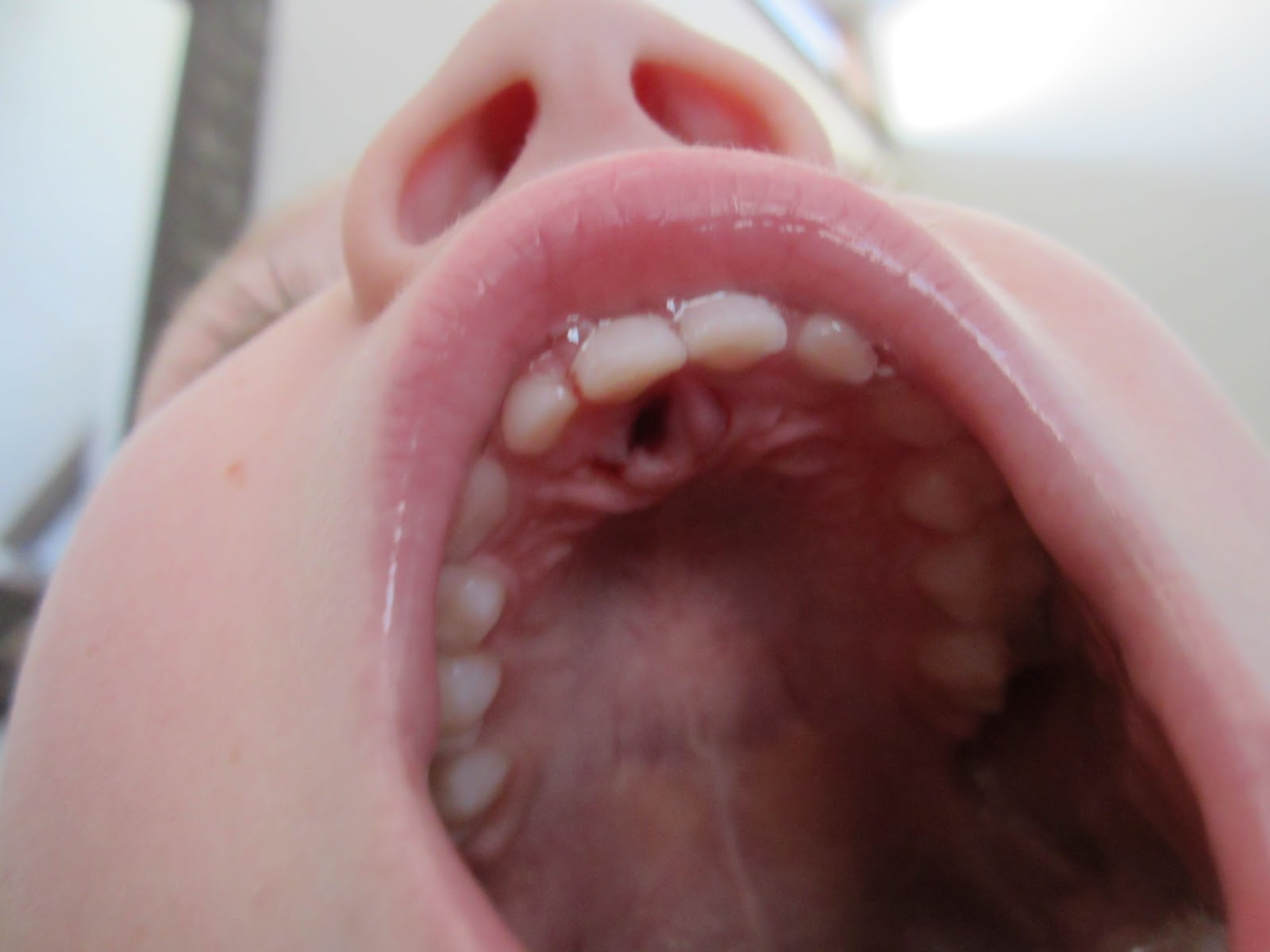 A Home for Darya: Adios shark tooth!