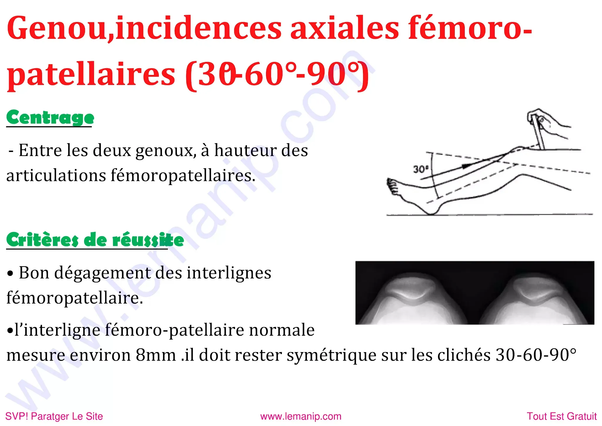 Genou femoro patellaire