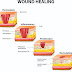 Healing: body’s replacement of destroyed tissues