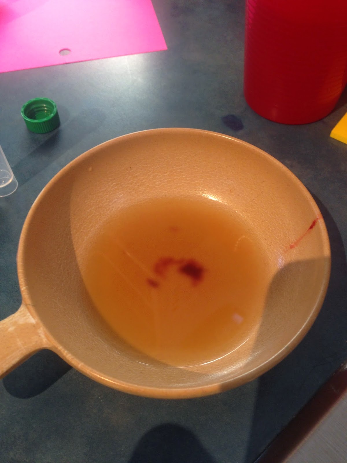 Decoding Bloody Urine: Hemolysis & Your Health Risks - 8h8nwu9