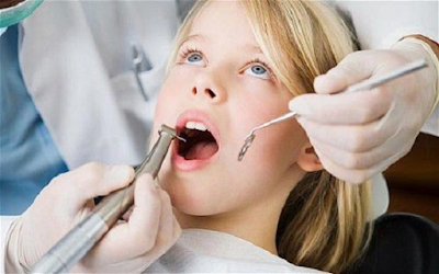 Có nên thực hiện cạo vôi răng cho trẻ em?