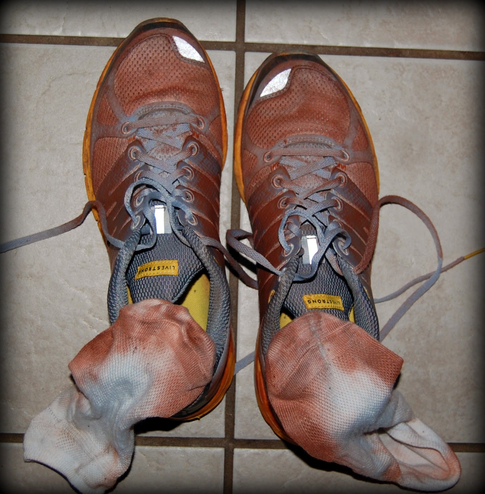 This Foot Condition Could Be Ruining Your Health (And You Don'T Even Know It) - 2u072q4