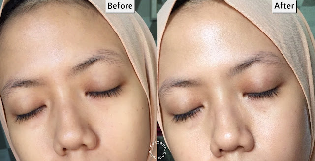 before after pemakaian scarlett brightly ever after cream