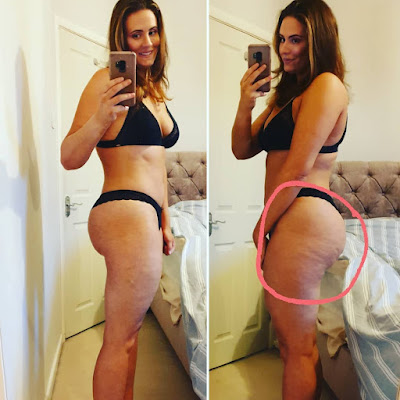 J'ai éliminé toute ma cellulite en 7 jours grâce à ce jus fait maison