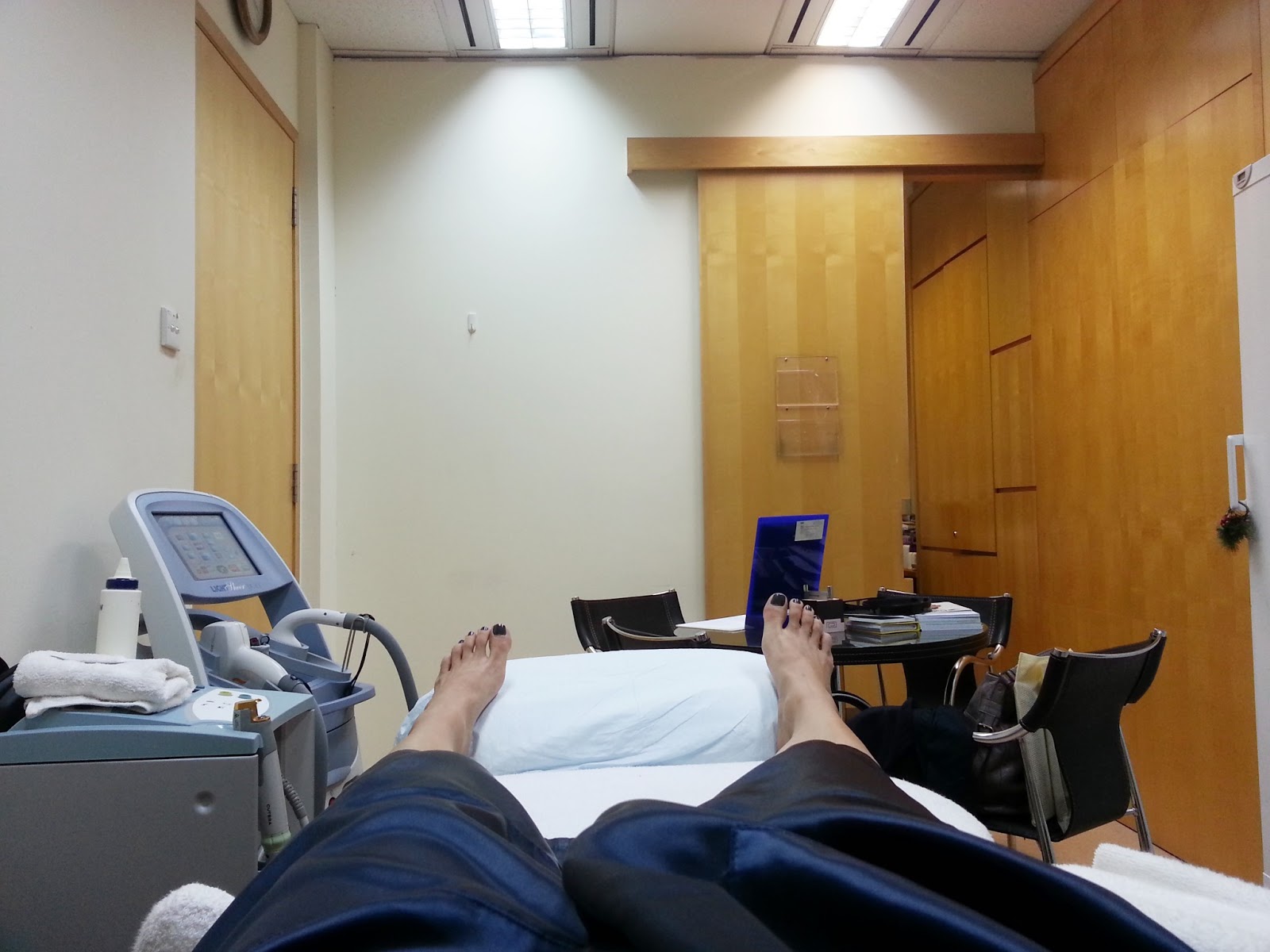 Moments In My Life Permanent Laser Hair Removal Lumenis, Most