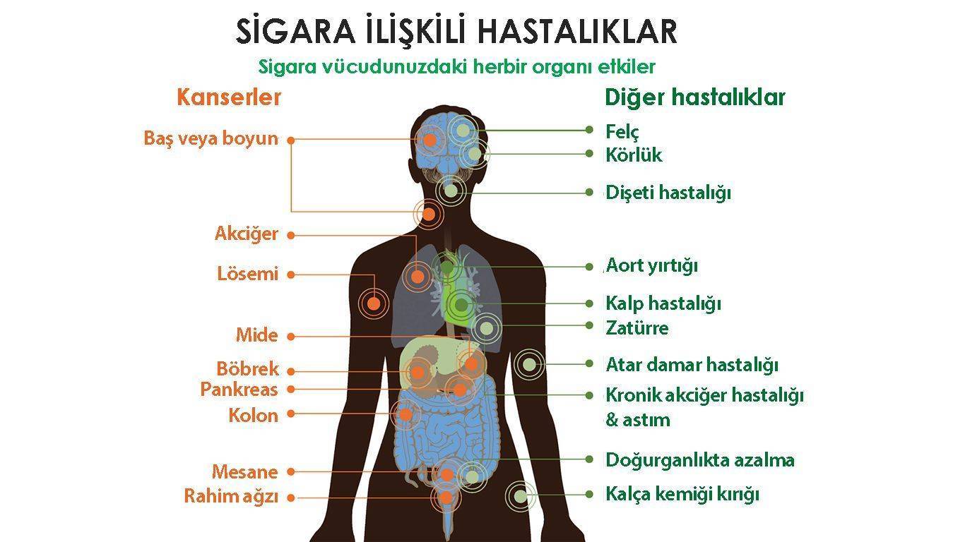Sigaranın Beyne Zararları Nelerdir ? Konulu Kompozisyon Yazınız. Oku