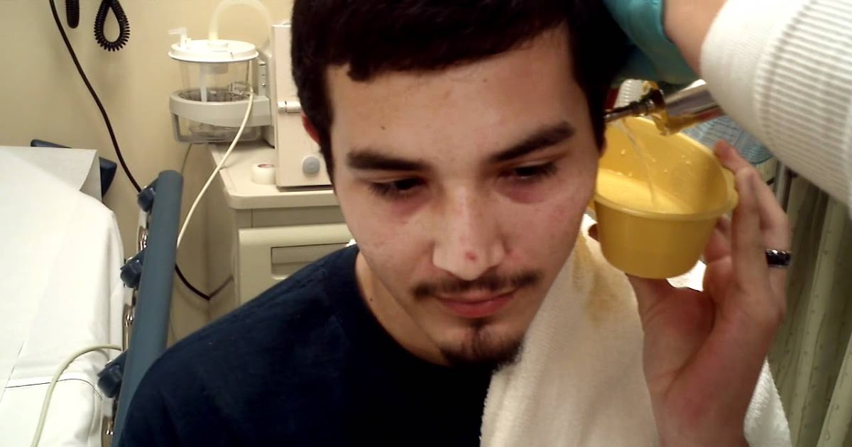 Ear wash technique, indications, contraindications and complications