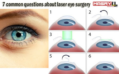 7 أسئلة شائعة حول جراحة العيون بالليزر common questions about laser eye surgery