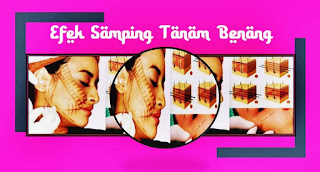 efek samping tanam benang