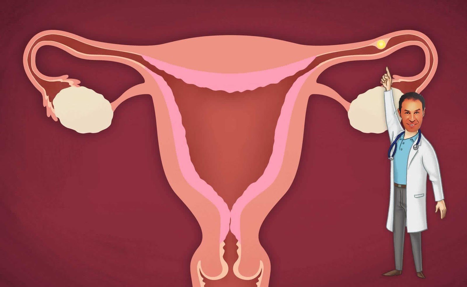 Без бесплодие. Внематочная Трубная беременность. Эктопическая Трубная беременность. Матка внематочная беременность. Оплодотворение женщины.