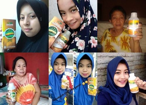 Cara Menyembuhkan Keloid Di Dada Dengan Cepat dan Efektif ~ TESTIMONI QNC JELLY GAMAT Cara Menyembuhkan Keloid Di Dada Dengan Cepat dan Efektif ~ TESTIMONI QNC JELLY GAMAT