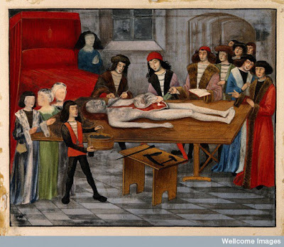 A brightly-colored image including three people cutting into a dead body on a table, with a crowd surrounding them.
