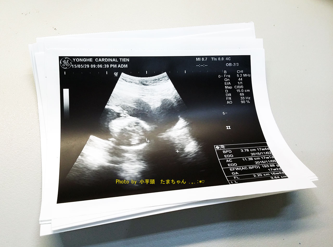 小芋頭的幸褔二加一進行式 孕事 如何保存珍貴的胎寶寶超音波照片 不建議用這個方法 會淡化