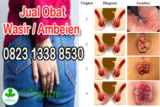 Merk Obat Ambeien Apotik Ampuh Khasiat Terbukti Manjur https://sediaobatwasir.blogspot.com/2019/09/merk-obat-ambeien-apotik-ampuh-khasiat.html