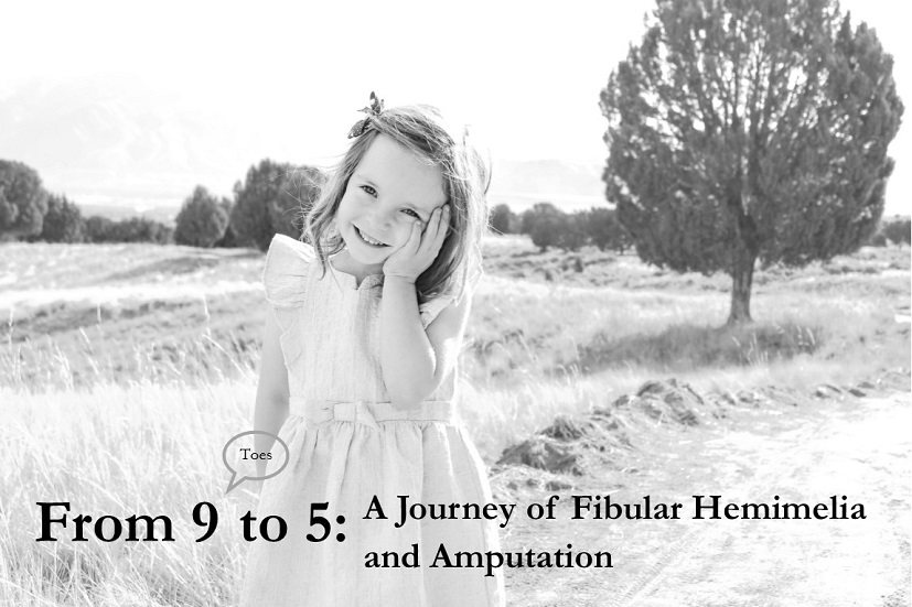 From 9 to 5: A journey of Fibular Hemimelia and Amputation