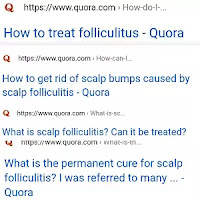 Scalp Folliculitis Treatment Scalp Folliculitis Treatment