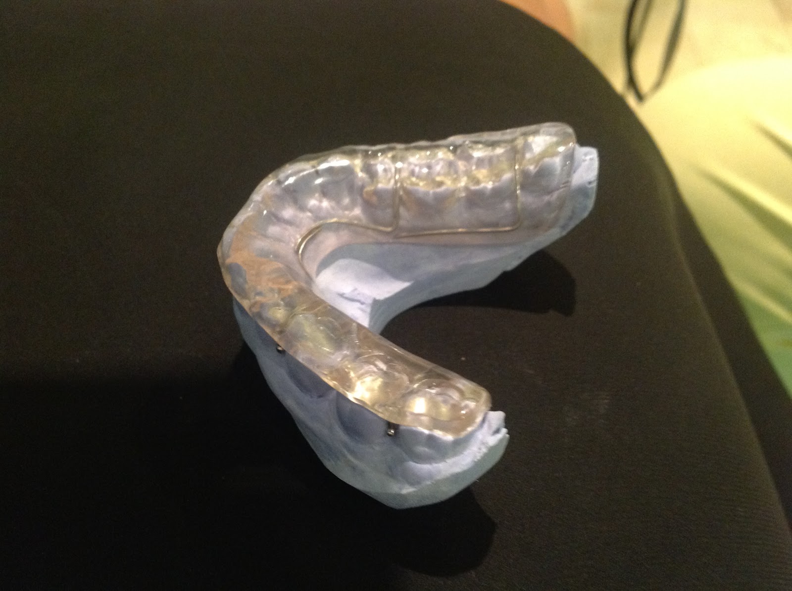 The Dyslexia Adventures You might have TMJ (Temporomandibular Joint