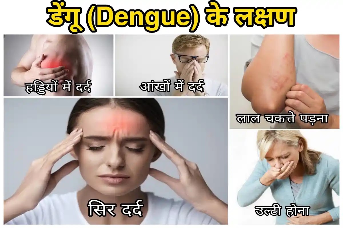 डेंगू बुखार: कारण, लक्षण, उपचार इत्यादि | Dengue symptoms in hindi डेंगू के लक्षण