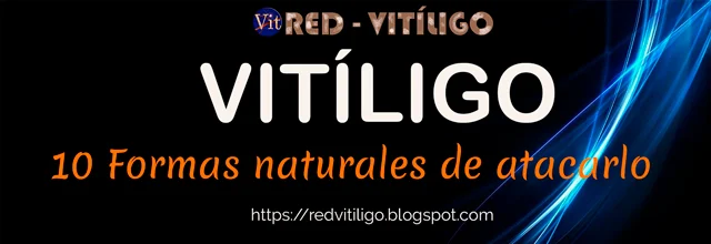 Vitiligo: 10 remedios recomendados para combatirlo