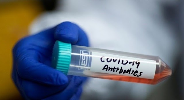 SAÚDE: Pesquisa identifica anticorpo que 'bloqueia' novo coronavirus