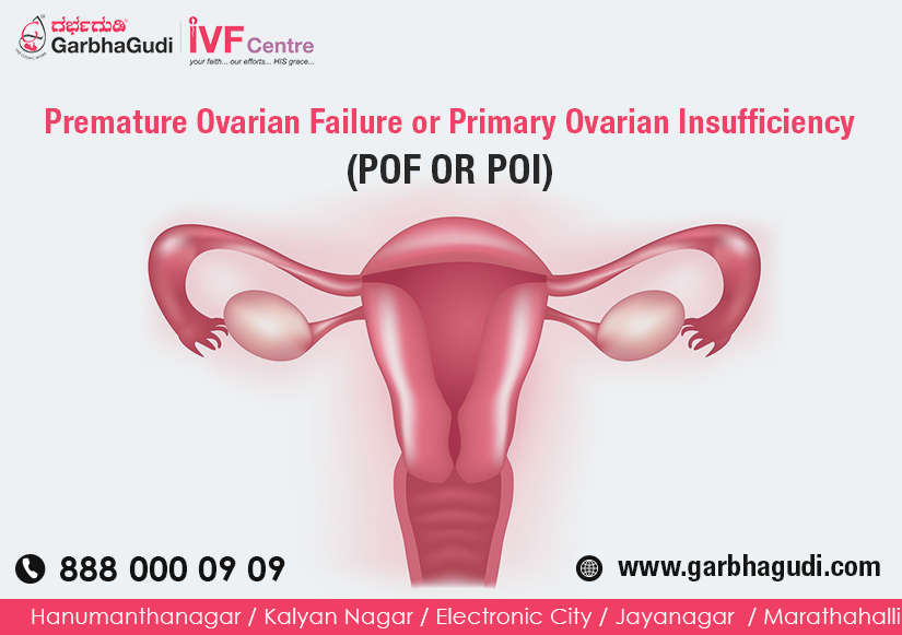 Premature Ovarian Failure or Primary Ovarian Insufficiency (POF OR POI)