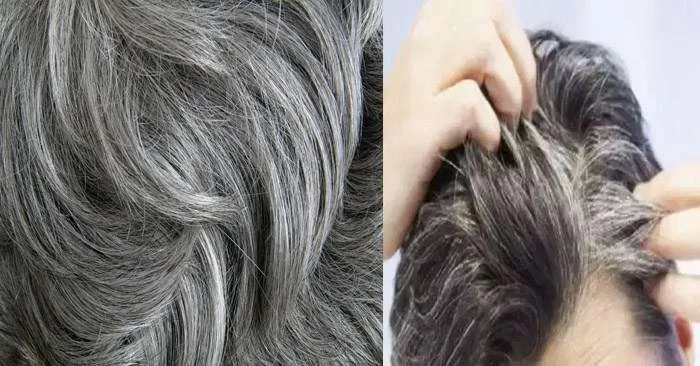 News, Kerala, Health, Beautiful, Technology, Scientists, Surgery, Science, Scientists have Figured Out Ways to Reduce Hair White