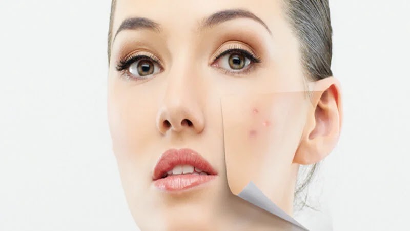 حلول لإزالة البقع السوداء من الوجه نهائياً