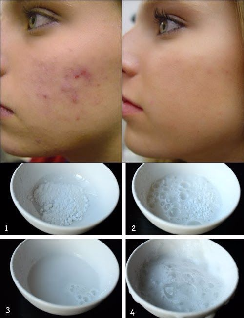 How to Remove Dark Spots From the Face Naturally Health and Beauty