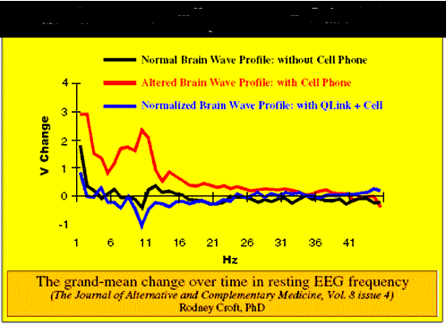 Promene u frekvenci moždanih talasa pod uticajem zračenja mobilnog telefona
