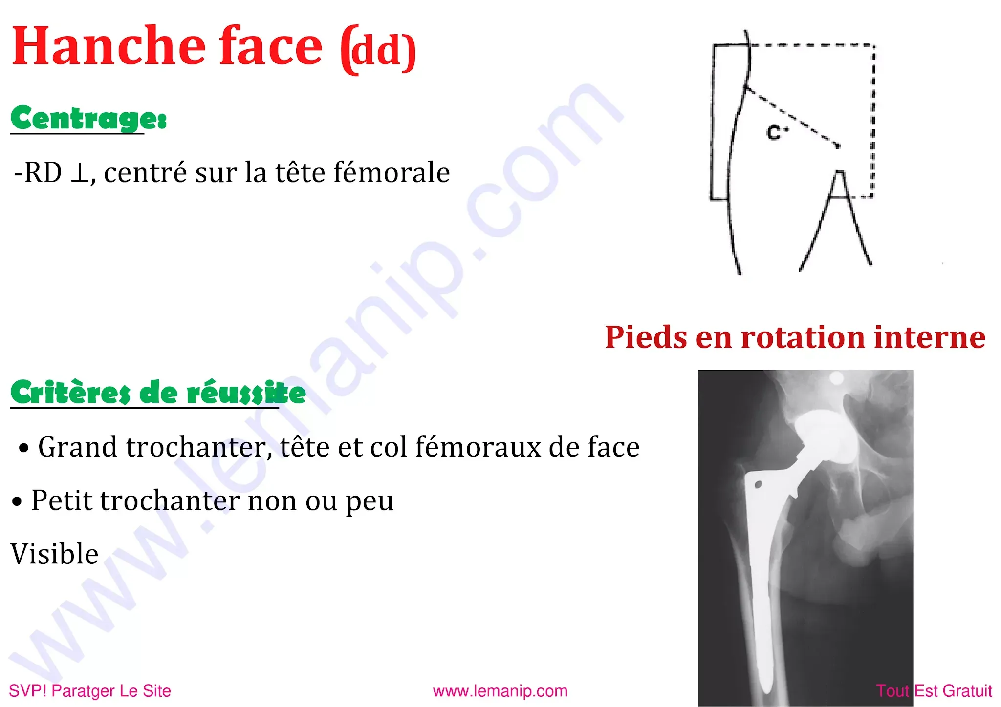 Hanche de face