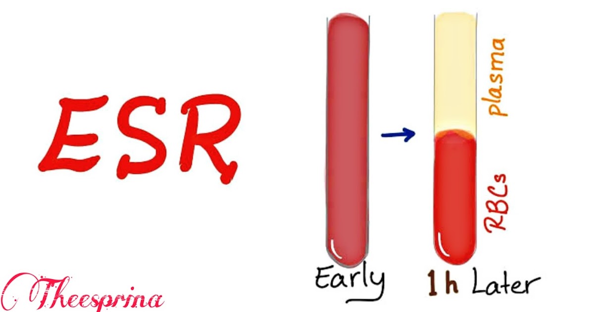 ما هو تحليل سرعة الترسيب التفاصيل كاملة عن تحليل سرعة الترسيب Esr Test