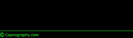 CAPNOGRAPHY TRONG GÂY MÊ Ở NGƯỜI LỚN