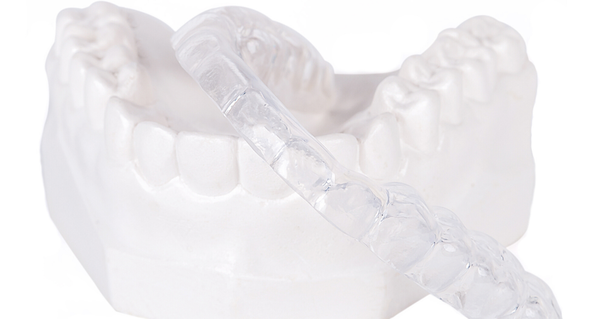 Top Tips for Finding the Best Bite Guard for Teeth Grinding