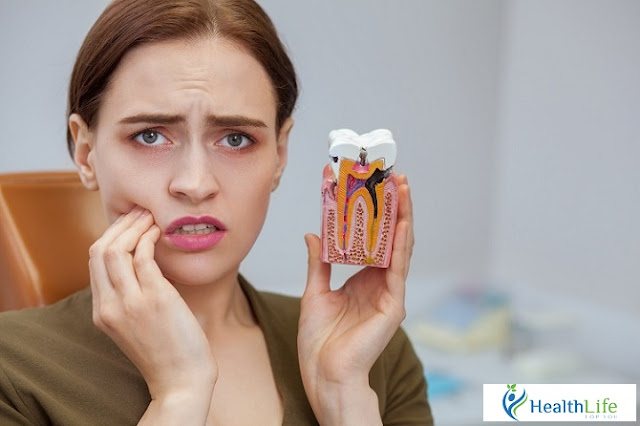 Purulent root inflammation: What do you know about this situation Purulent root inflammation: What do you know about this situation