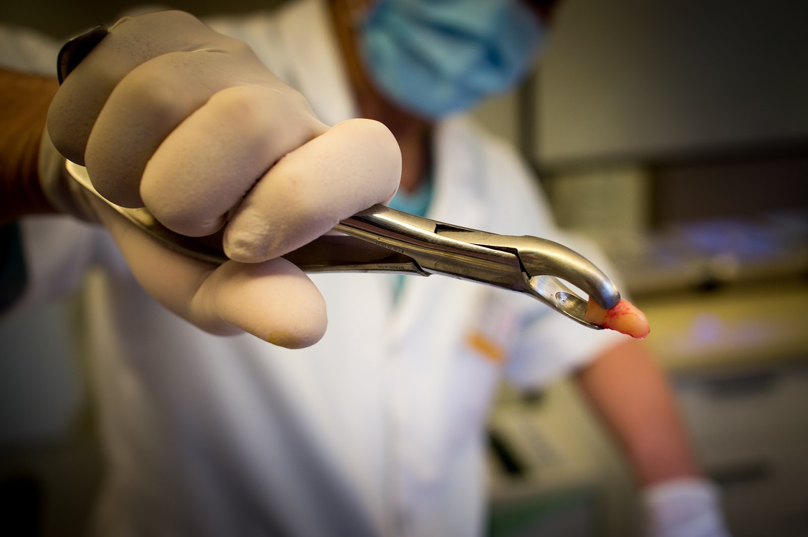 abscess pop dental ways mouth yourself inside verbal own