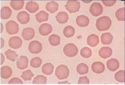 Vet World: Hematologia