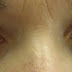 How I Lose My Eyesight? A Drastic Truth