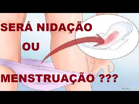 Featured image of post Corrimento Marrom Sangramento De Nida o Fotos Reais