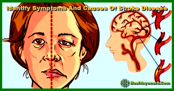 Identify symptoms and causes of stroke disease Identify symptoms and causes of stroke disease