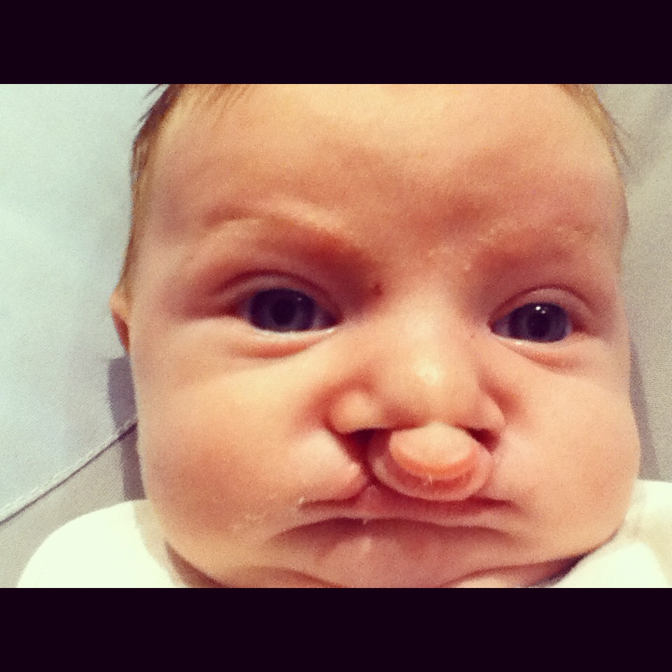 Mama van 3 Ons Schisis verhaal