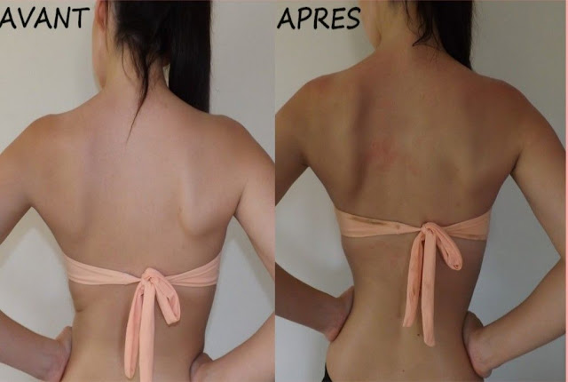 Conseils pur obtenir un bronzage rapide naturellement